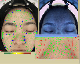 A camada portátil da derma do cosmético da análise da pele e do terapeuta da pele detecta