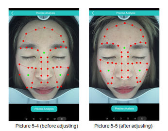 CE facial do sistema de análise de Digitas do analisador médico da pele 3D certificado