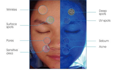 Para o CE branco FDA do analisador mágico cosmético da pele do espelho do analisador da cara do analisador 3D do doutor Profissional Pele Análise Facial