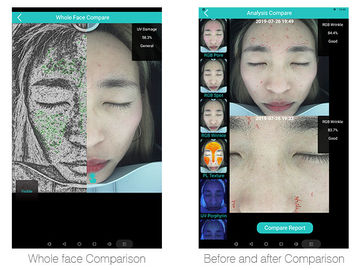 Do analisador facial da pele da clínica da pele equipamento essencial da detecção da pele