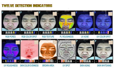 Do analisador facial da pele da clínica da pele equipamento essencial da detecção da pele