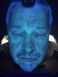 A máquina facial profissional da análise da pele com partilha poderia armazenamento