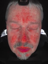 Análise facial do varredor da pele, máquina do analisador da pele com certificado do Ce