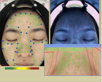 Máquina facial profissional do analisador da hidratação da pele 3d com tela táctil