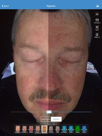 Armazenamento facial de Visia 32gb do varredor do analisador da pele 3d para o doutor Pele Clínica