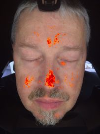 verificador mágico do espelho do analisador da pele de 3D Digitas para a clínica cosmética do terapeuta