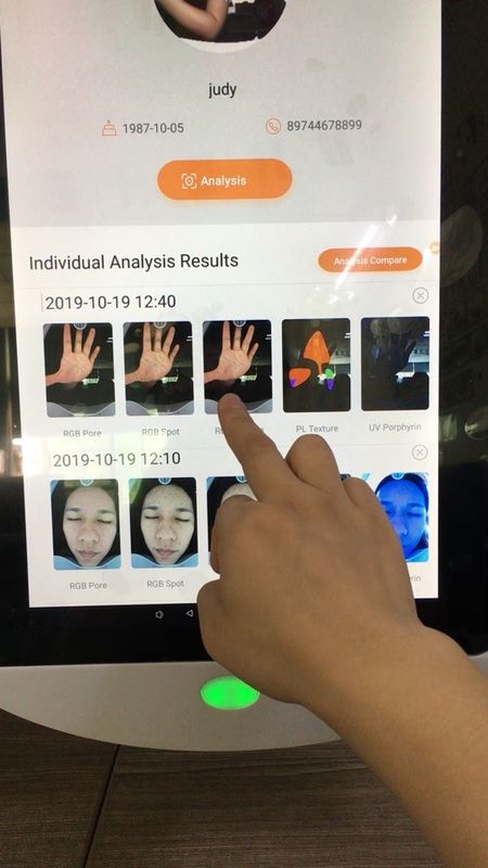 Armazenamento facial de Digitas 64gb do sistema de análise de Coreia para o doutor Clínica