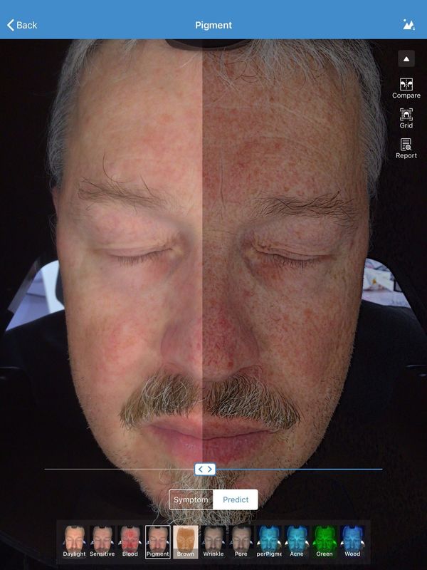 Armazenamento facial de Visia 32gb do varredor do analisador da pele 3d para o doutor Pele Clínica