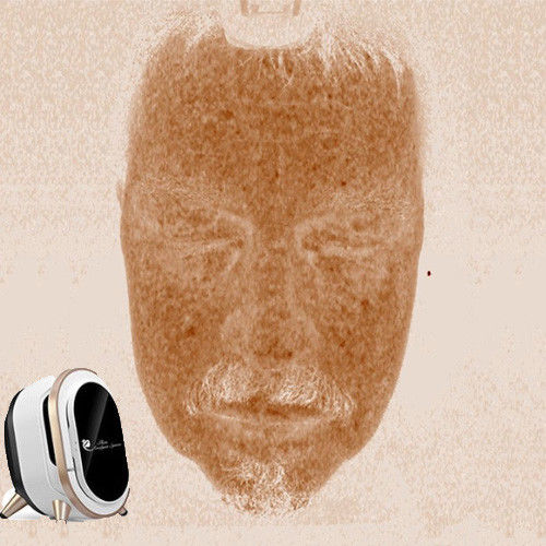 Analisador portátil profissional da pele, tensão facial da análise 110-220V da pele